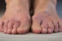 feet crippled by neuropathy pain and numbness